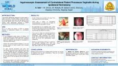 Inguinoscopic Assessment Of Contralateral Patent Processus SIU   356091 